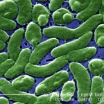 O bacterie carnivora genereaza panica in Florida