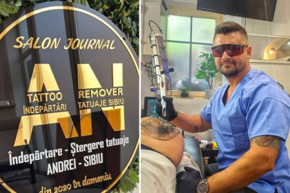 Unic in Sibiu Tehnologia rapida si ushoara de stergere a tatuajelor
