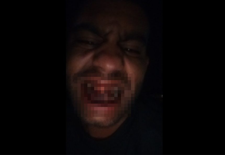 incident pe strada rahovei un sibian acuza jandarmii de bataie nevinovata am ajuns la urgente video