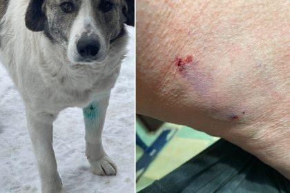 Femeie din Sura Mare muscata de cainii proprii