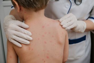 Statistic alarmant aproape jumtate dintre copii nu sunt vaccinai mpotriva rujeolei