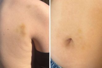 cazul copilului agresat de tatal unui coleg in parc la sibiu are fractura nazala iar mama a cerut un ordin de protectie