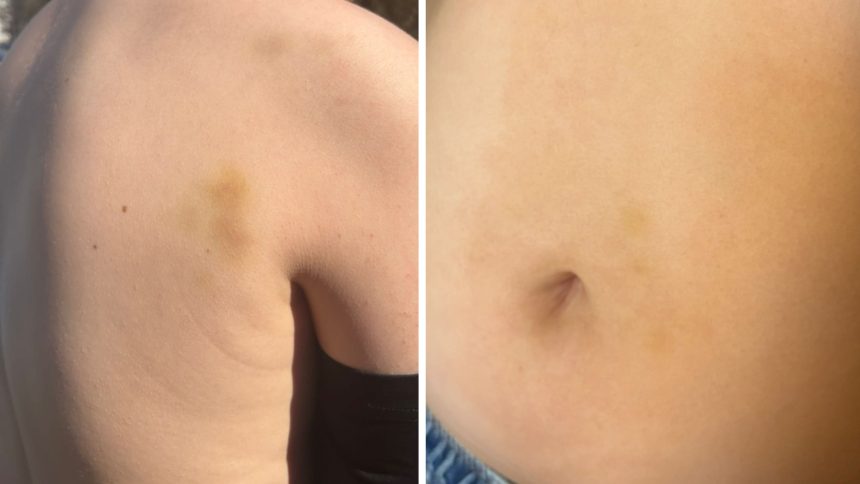 cazul copilului agresat de tatal unui coleg in parc la sibiu are fractura nazala iar mama a cerut un ordin de protectie