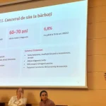 Bărbații pot face și ei cancer de sân. Oncolog: „De multe ori, diagnosticul vine târziu”